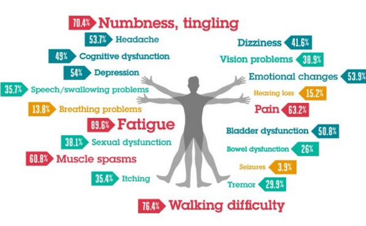 Simptomi multipla skleroze1